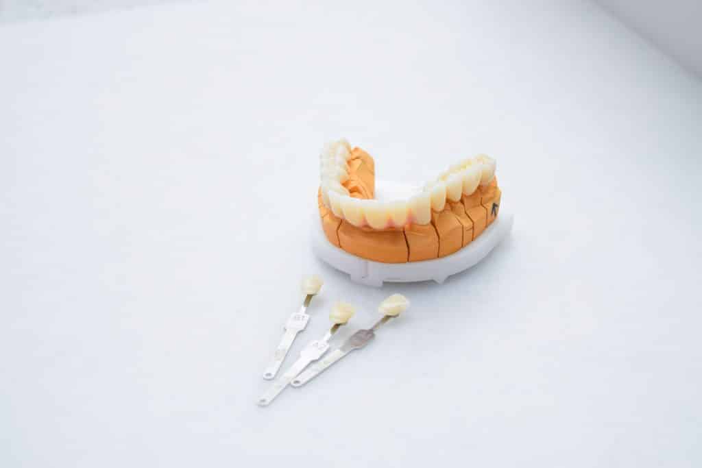 Zubne ljuskice Veneers