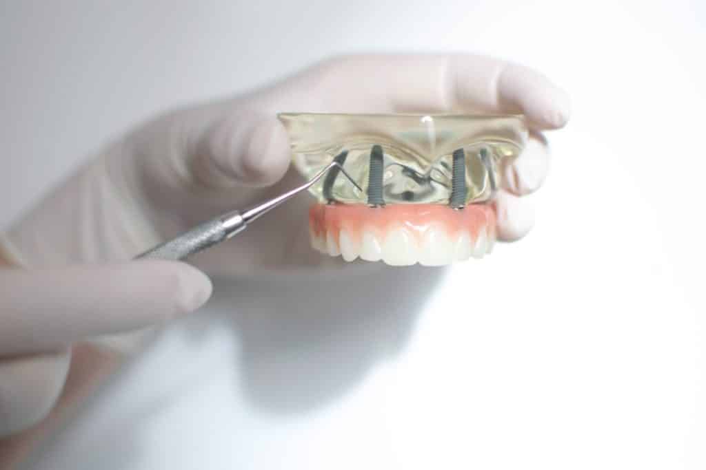 Zubni implantati